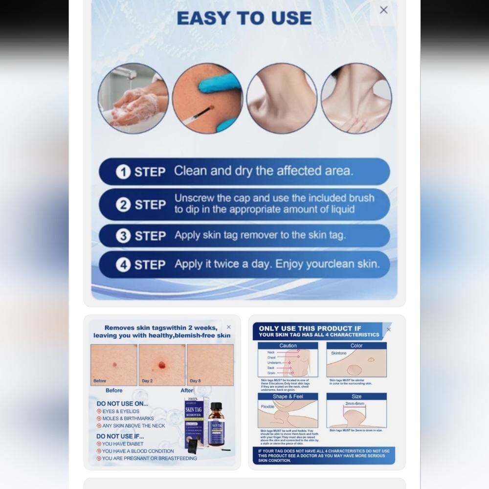 Zrizl Advanced Skin Tag Remover - Bundle Of 3 - Picture 4 of 6